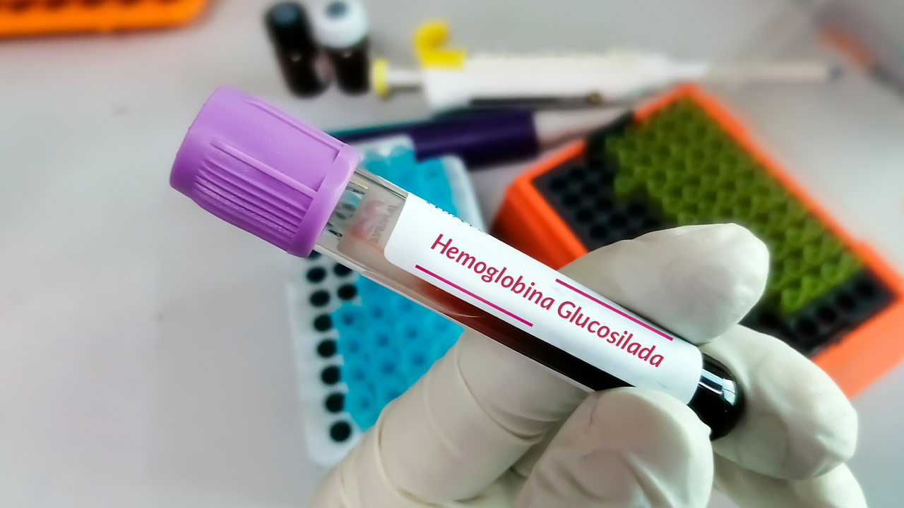 La Prueba De Hemoglobina Glucosilada Lapi Laboratorio Médico 2671