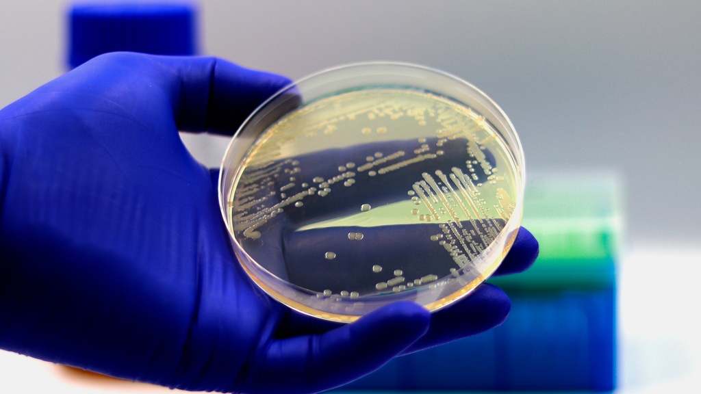 Coprocultivo Lapi Laboratorio Médico