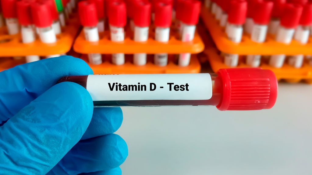 25 - Hidroxivitamina D (D3)