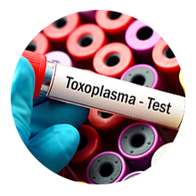 Ac. Anti - Toxoplasma IgM