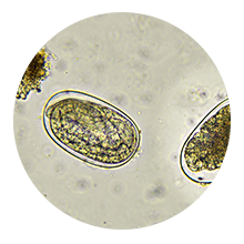 Toxina A y B de Clostridium difficile