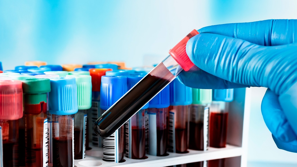 Ac. Anti - Nucleares