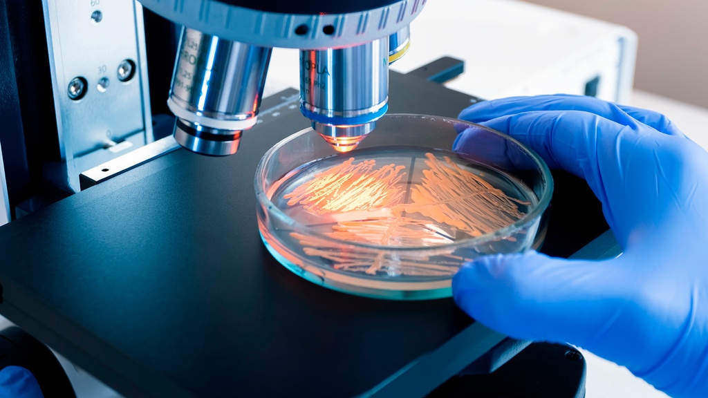 Coproparasitoscópico 2 Muestras