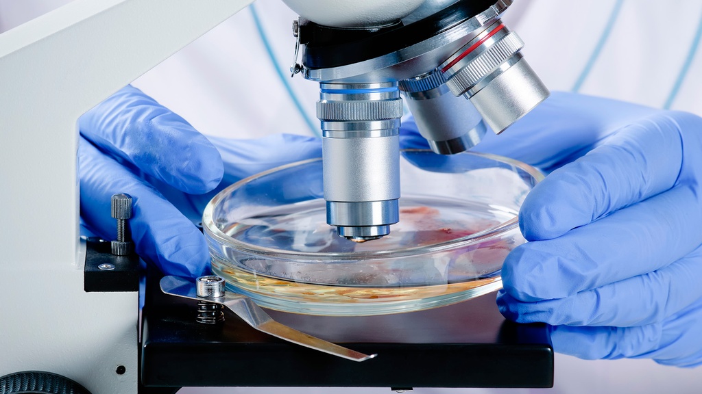 Coproparasitoscópico 3 Muestras