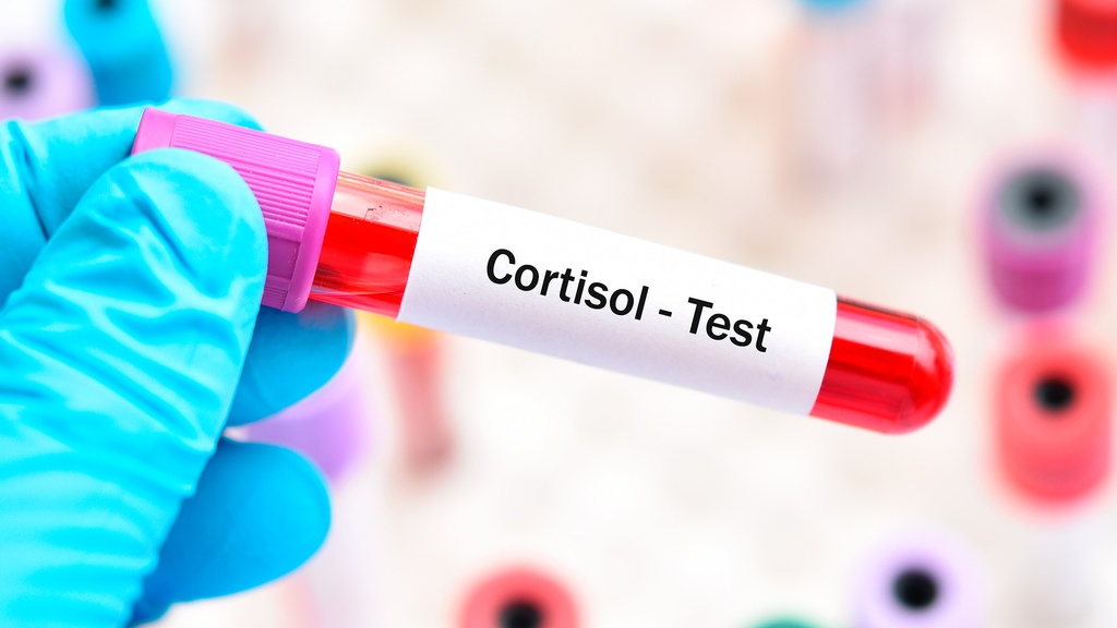 Cortisol Sérico