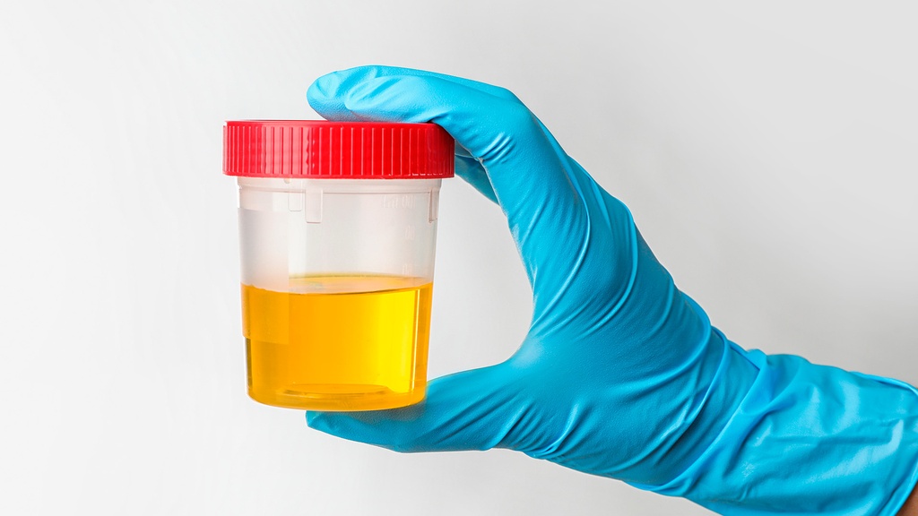 Cortisol en Orina de 24 hrs. (Libre)