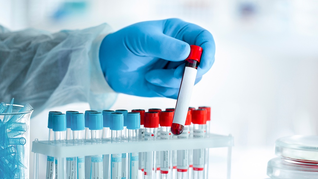 Deshidrogenasa Láctica