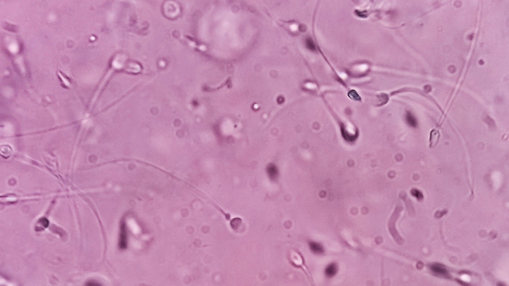 Espermocultivo (Cultivo de Semen)