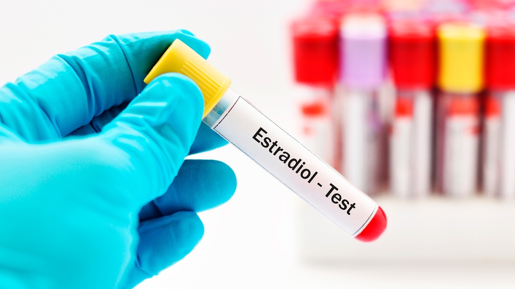 Estradiol en Suero