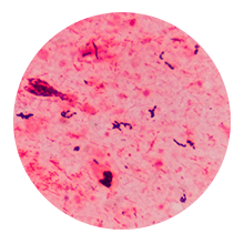 Cultivo de Ureaplasma