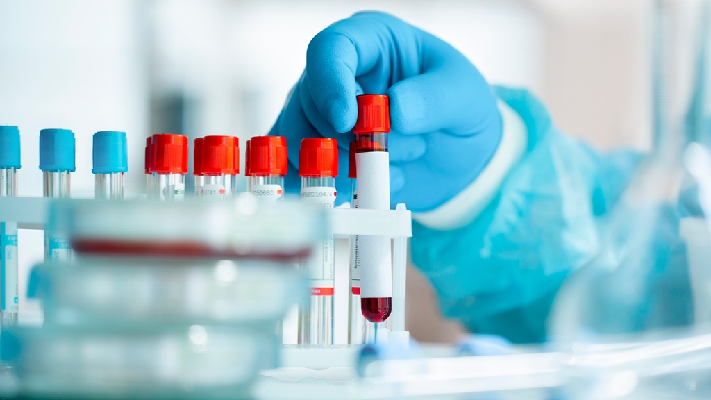 Insulina Post.-Prandial 2 hrs.