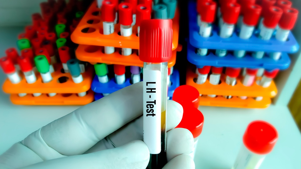 L. H. (Hormona Luteinizante)