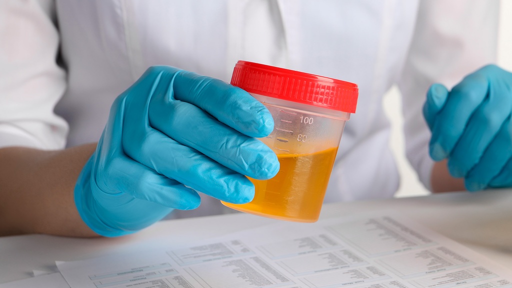 Prueba Inmunológica de Embarazo