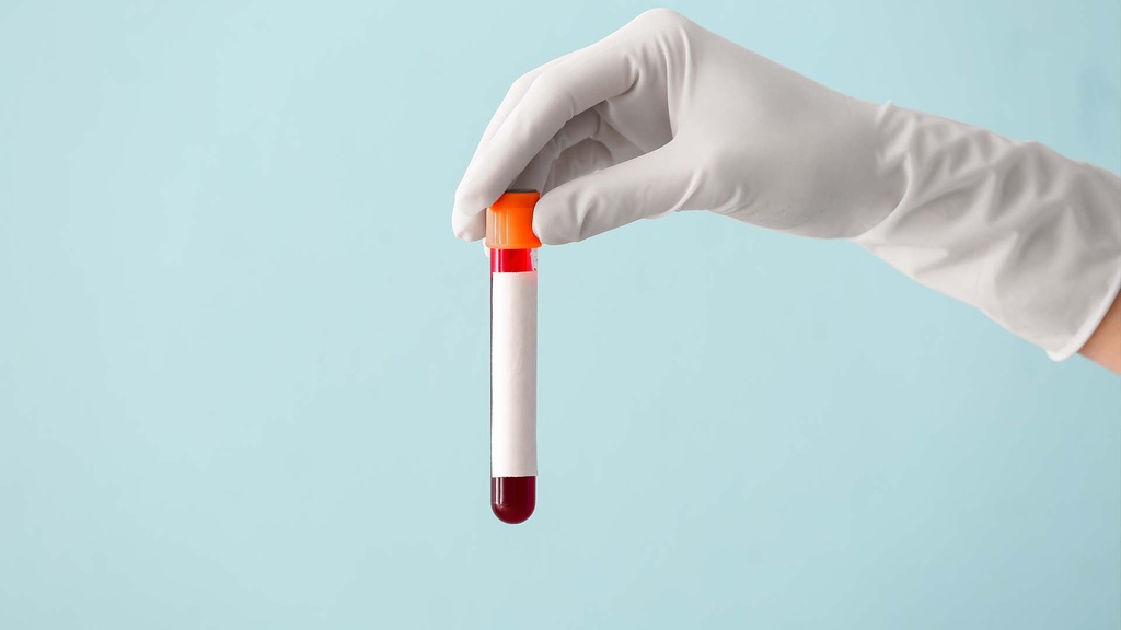 Química Sanguínea  de 35 Elementos