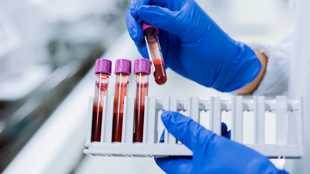 Tiempo de Coagulación