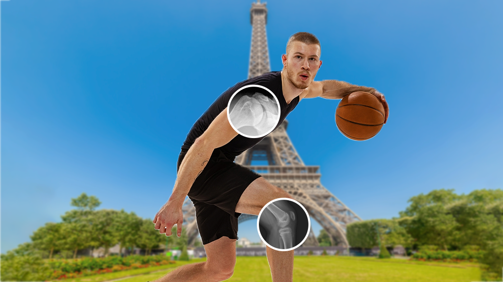 Rx Edad Osea 1 Proyección ( Mano Izquierda )