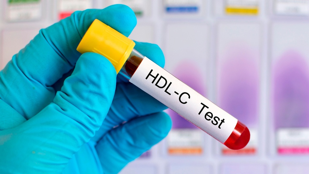 Colesterol de Alta Densidad (HDL)