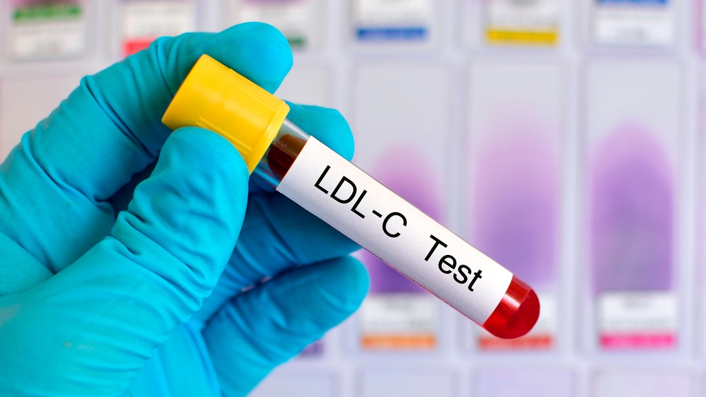 Colesterol de Baja Densidad (LDL)