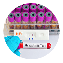 Perfil Hepatitis "B"