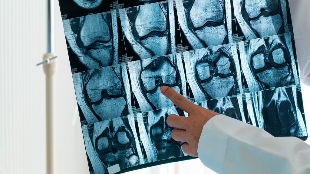 Resonancia Magnética Rodilla Izquierda