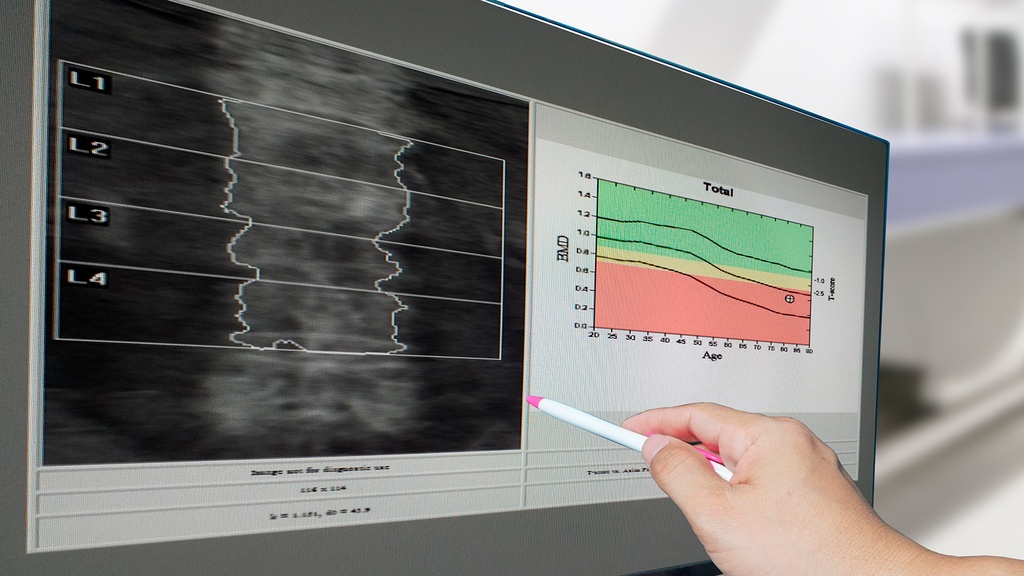 Densitometria 1 Region