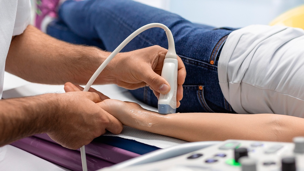 Doppler Arterial De Miembro Superior Izquierdo