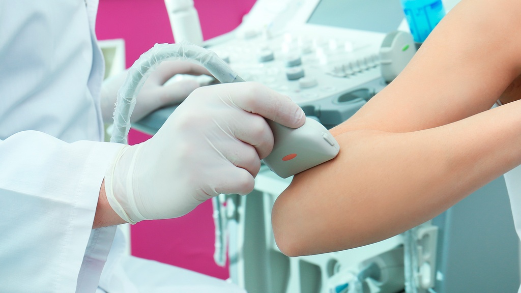 Doppler Venoso Bilateral De Miembros Superiores