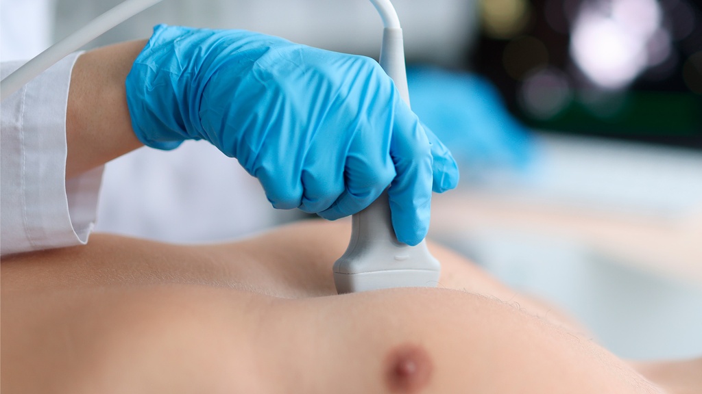 Ecocardiograma Transtorácico en Reposo