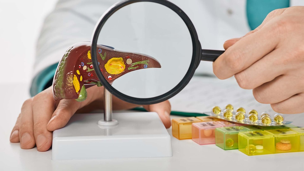 Perfil Hepatitis "A"