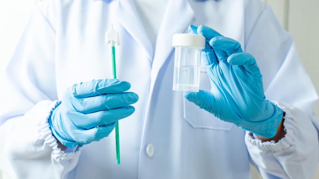 Colposcopia y Papanicolaou en Base Líquida