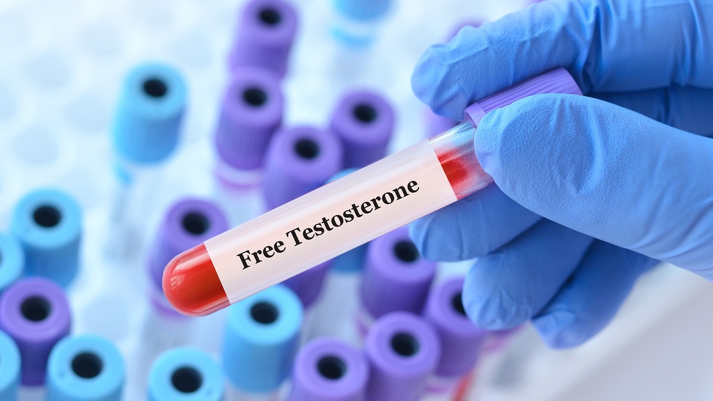 Testosterona Libre