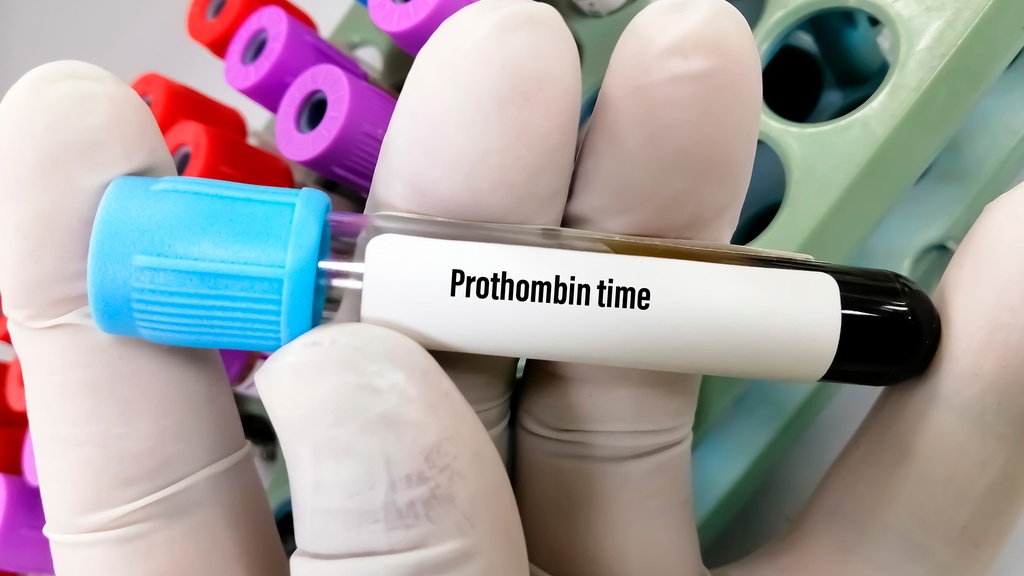 Tiempo de Protrombina | Lapi Laboratorio Médico
