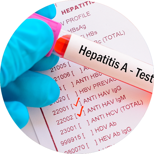 Perfil Hepatitis "A"