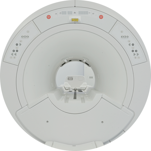 Resonancia Magnética Muneca Derecha
