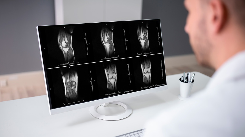 Resonancia Magnética Rodilla Derecha
