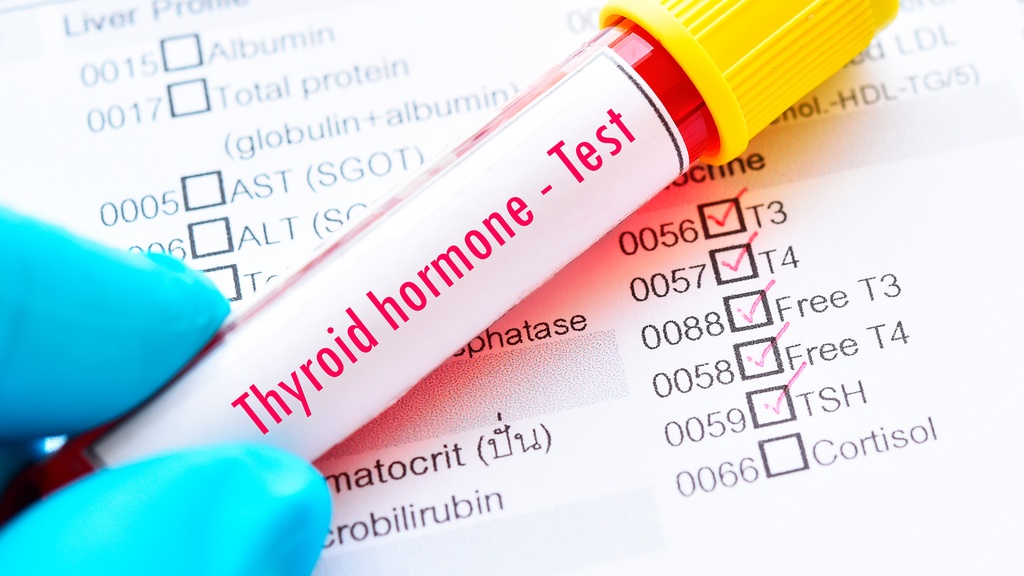 Perfil Hormonal Con Tiroideo