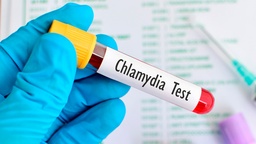 [CHLAINM] Chlamydia (Detección de antígeno)
