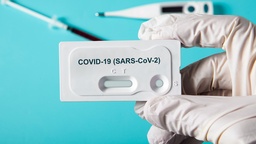 [COVIDIG2] SARS-CoV-2 IgG (2a Generacion)