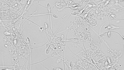 [ESPASEM] Espermatobioscopía (Seminograma)