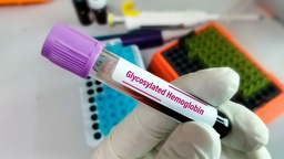 [HEMGLU] Hemoglobina Glucosilada (HB A1C) en sangre total