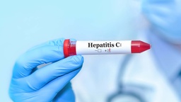 [PEHEPC] Perfil Hepatitis "C"