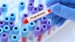 [PROGES] Progesterona