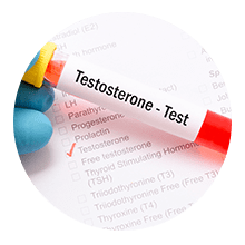 [TESTOS] Testosterona Total