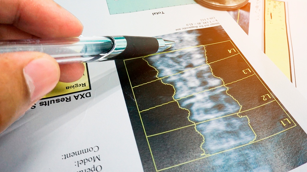 Densitometría de Columna Lateral