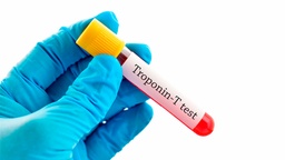 [TROPOT] Troponina T