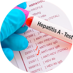 [PEHEPA] Perfil Hepatitis "A"