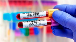 [LIHDLD] Lipoproteínas HDL / LDL