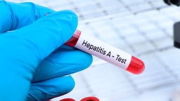 [ACANVHG] Ac. Anti - Hepatitis A (IgG)