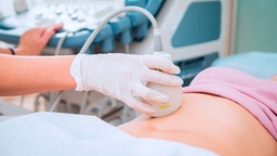 [USFOIL] Ultrasonido Fosa Iliaca Derecha