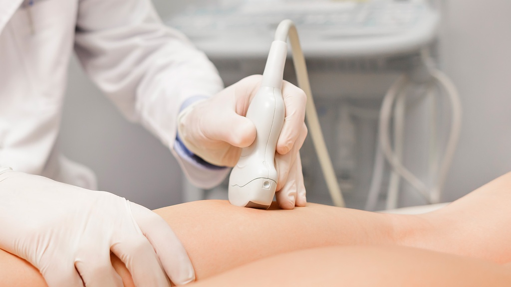 Doppler Arterial Y Venoso De Miembro Inferior Izquierdo